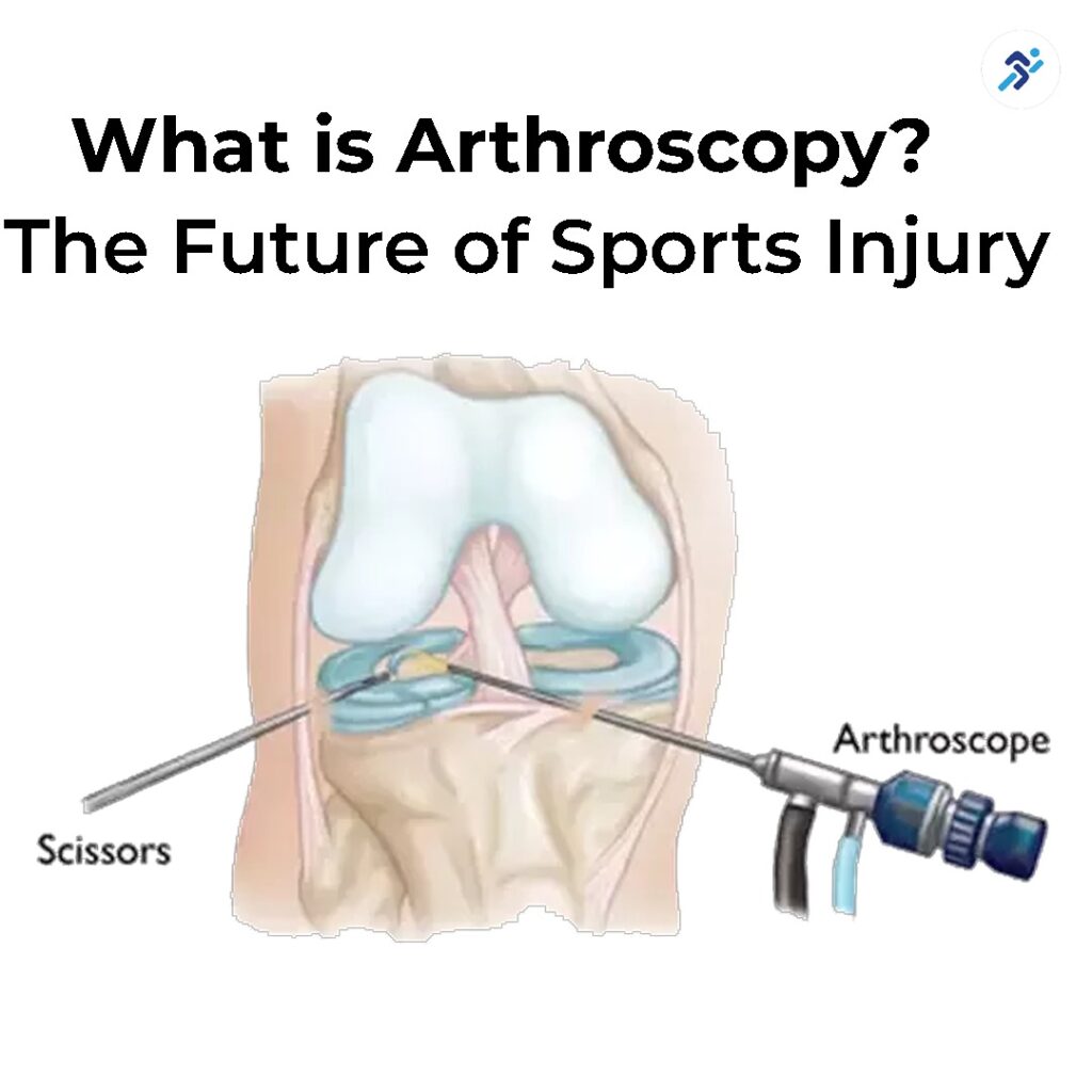 What Is Arthroscopy? The Future of Sports Injury Treatment