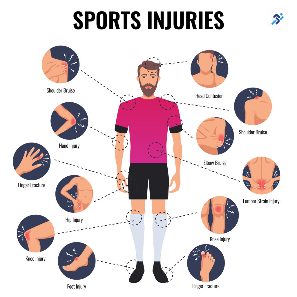 Top 5 Most Common Sports Injuries and How to Prevent Them